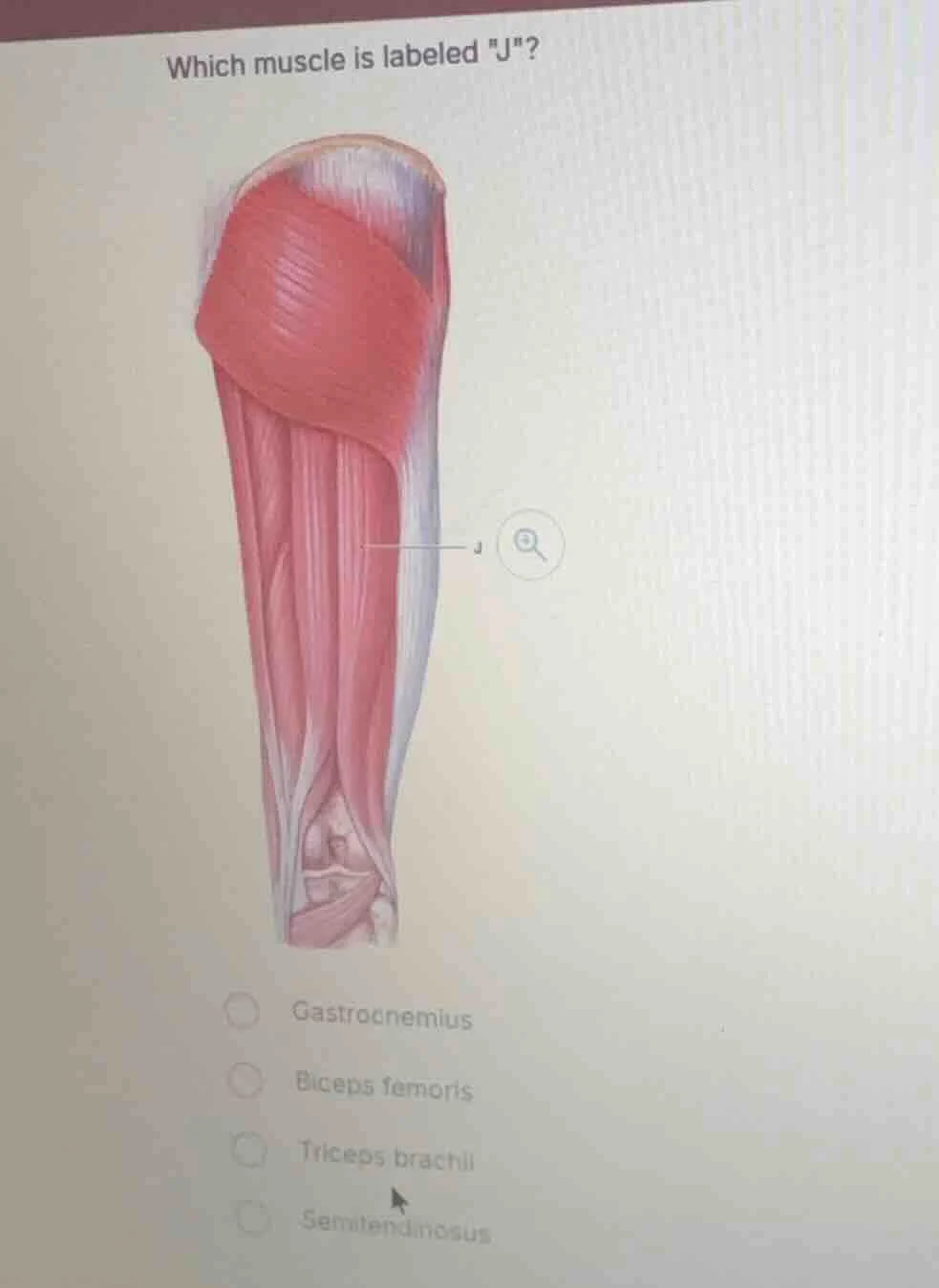 which muscle is labeled \j\?gastrocnemiusbiceps femoristriceps brachiis…