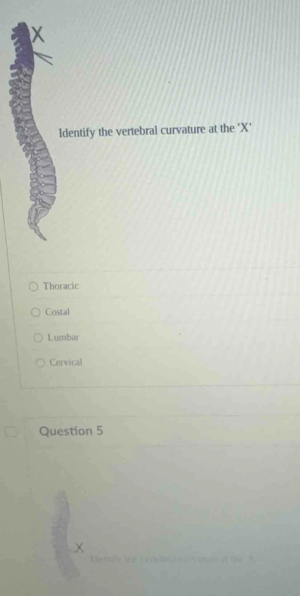 identify the vertebral curvature at the x thoracic costal lumbar cervic…