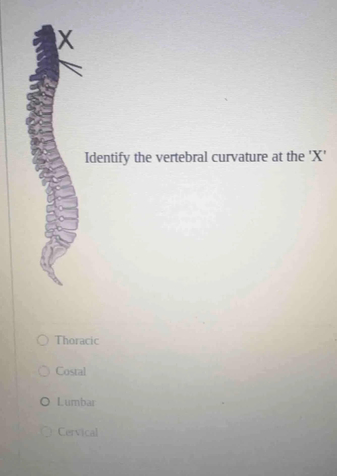 identify the vertebral curvature at the x thoracic costal lumbar cervic…