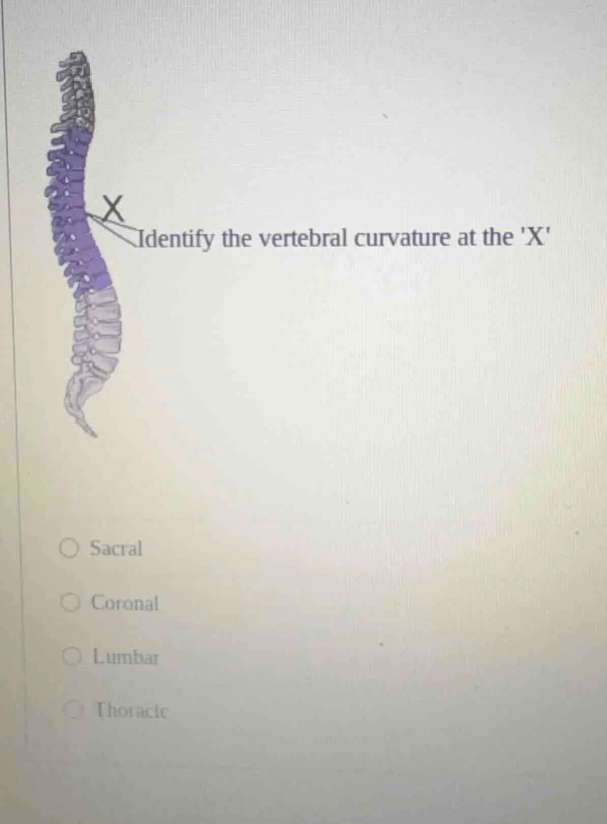 identify the vertebral curvature at the x○ sacral○ coronal○ lumbar○ tho…