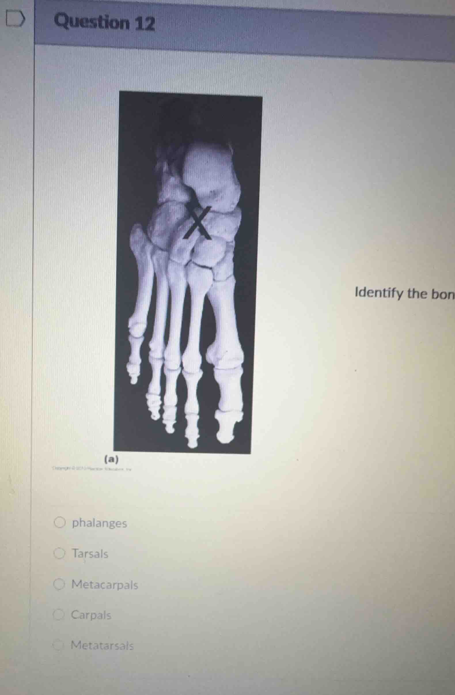 question 12 identify the bon (a) ○ phalanges ○ tarsals ○ metacarpals ○ …