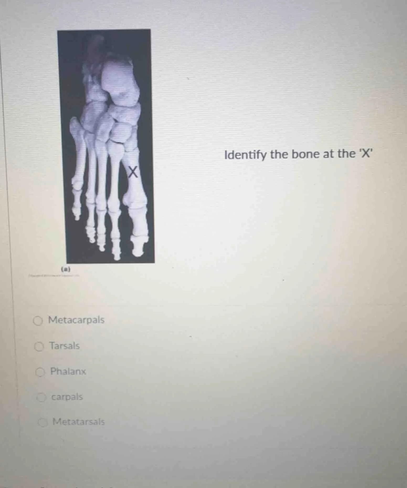 identify the bone at the x metacarpals tarsals phalanx carpals metatars…