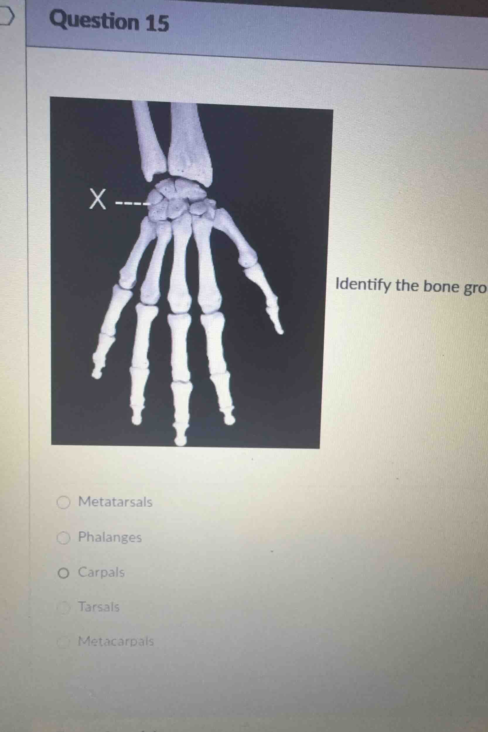question 15 identify the bone gro metatarsals phalanges carpals tarsals…