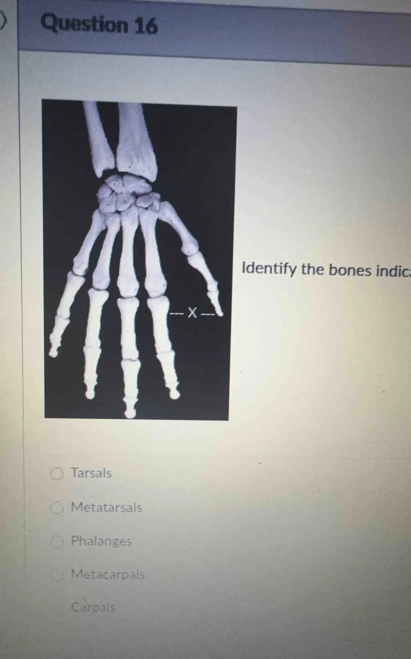 question 16 identify the bones indic ○ tarsals ○ metatarsals ○ phalange…