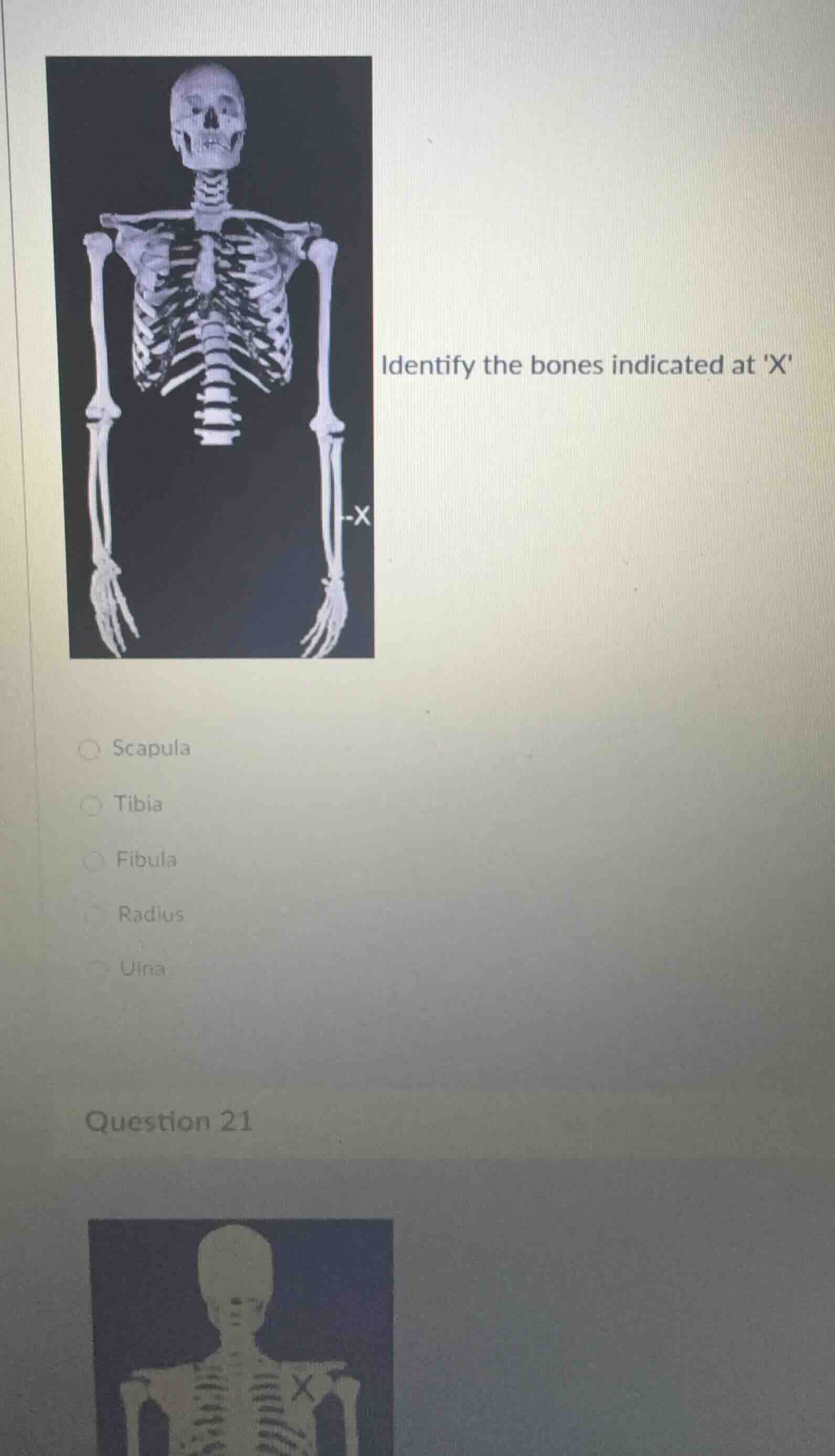 identify the bones indicated at xscapulatibiafibularadiusulnaquestion 21