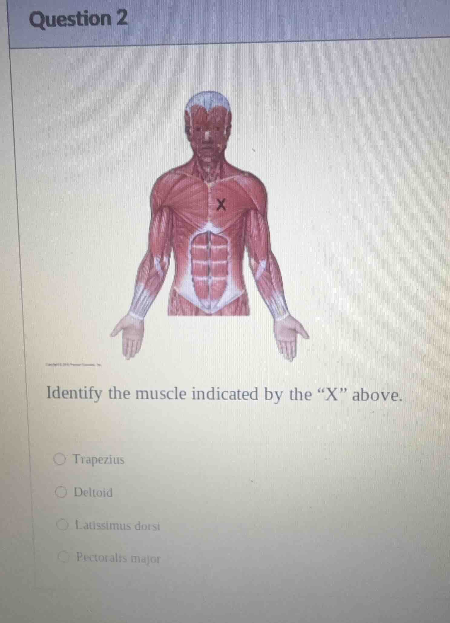 question 2 identify the muscle indicated by the \x\ above. trapezius de…