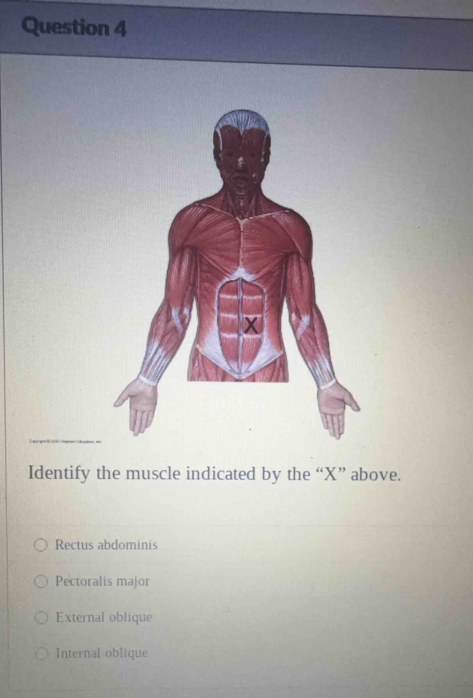 question 4 identify the muscle indicated by the \x\ above. □ rectus abd…