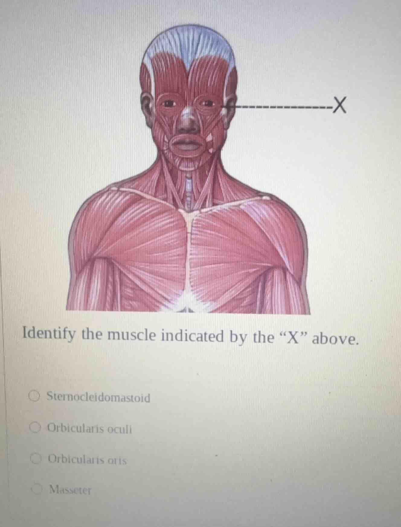 identify the muscle indicated by the “x” above. ○ sternocleidomastoid ○…