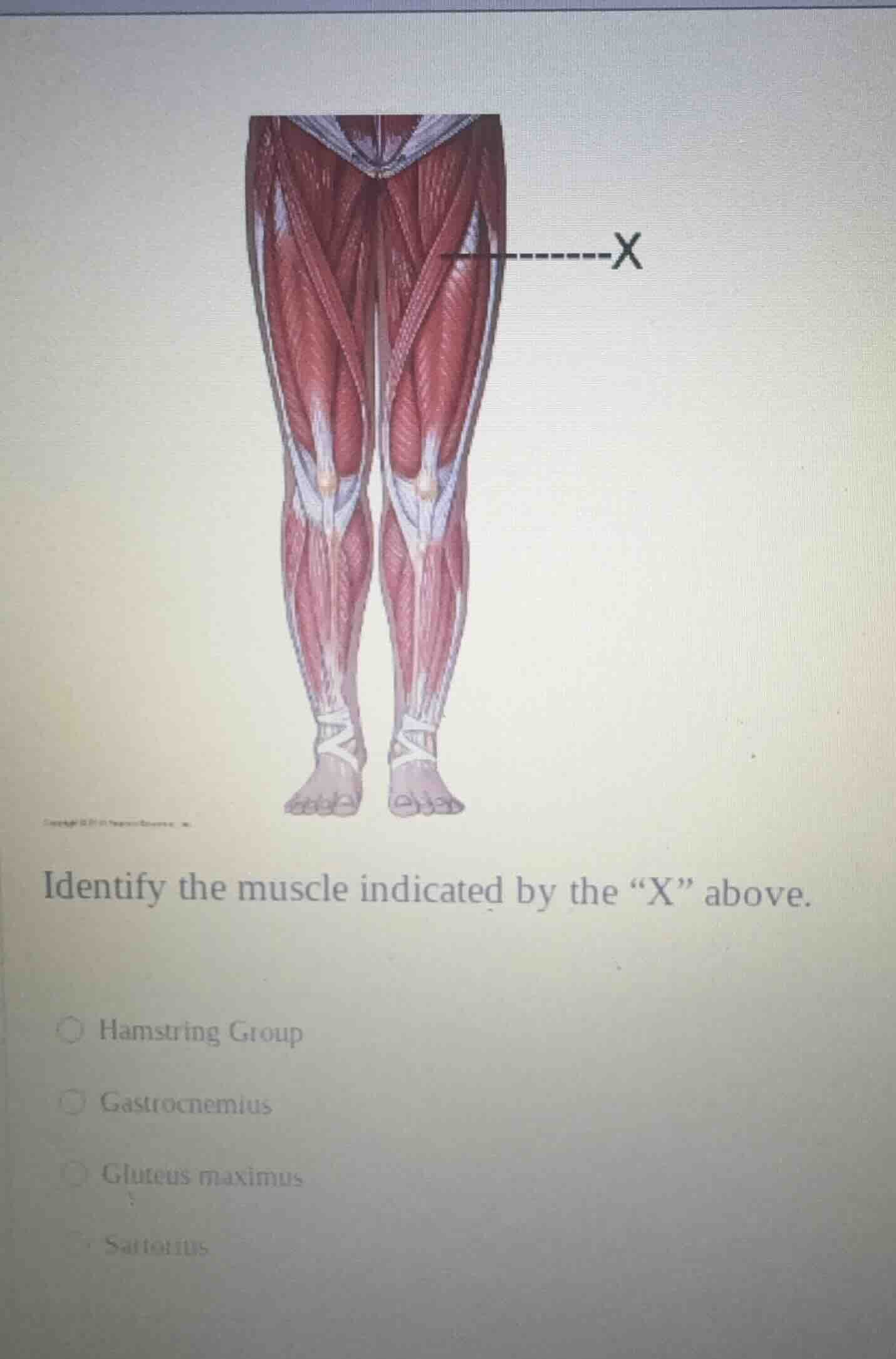 identify the muscle indicated by the “x” above. ○ hamstring group ○ gas…